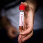 Comprehensive Global Coronavirus Daily Update Covering the Jewish and Secular Communities