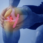 How Colonoscopies May Harm Gut Health—and How to Help