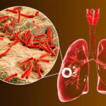Fat-Burning Sitting Exercise Lowers Blood Sugar