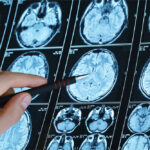 HHS Rolls Out MAHA in Action to Spotlight Health Reforms