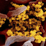 Coronavirus Lessons for the Coalition Talks